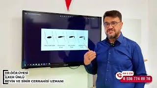 Patlamış Fıtık Nedir?